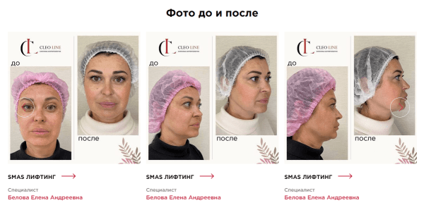 Улучшили юзабилити сайта и увеличили конверсию пользователя в клиента на 24%. Кейс